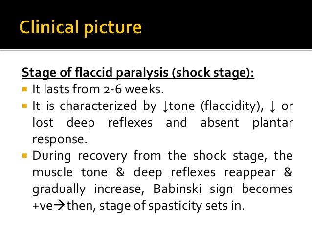 Flaccid Hemiplegia Flaccid Hemiplegia